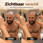 Eclipse Shaver